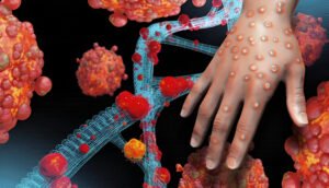 Mpox remains public health emergency of international concern – WHO