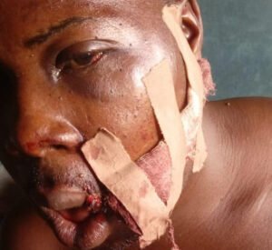 Ogun community protests alleged police bias over Supreme Court land ruling