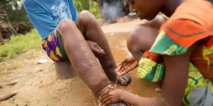 30m Nigerians on treatment for NTDs – Official