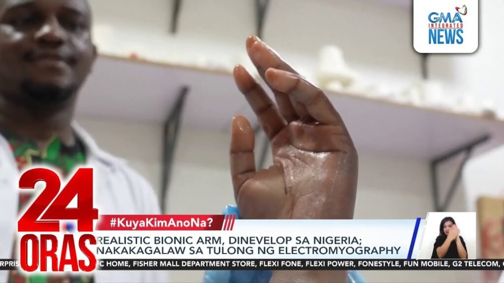 Realistic bionic arm, dinevelop sa Nigeria; nakakagalaw sa tulong ng electromyography | 24 Oras