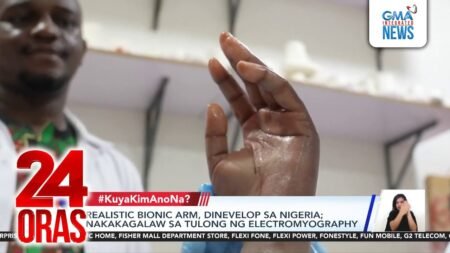 Realistic bionic arm, dinevelop sa Nigeria; nakakagalaw sa tulong ng electromyography | 24 Oras