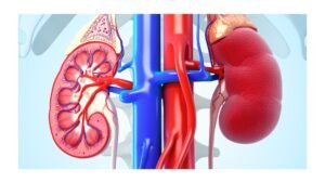 UPDATED: Tinubu subsidises dialysis treatment in public hospitals