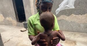 SPECIAL REPORT: Food Inflation worsens child malnutrition crisis in northern Nigeria