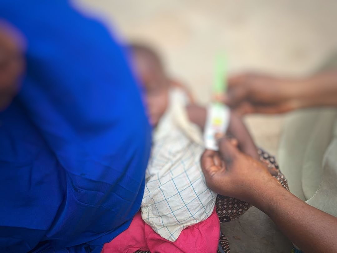 A health worker measures a Hussein Isah's arm with a MUAC tape to assess moderate acute malnutrition. (PHOTO CREDIT: Ayodeji )