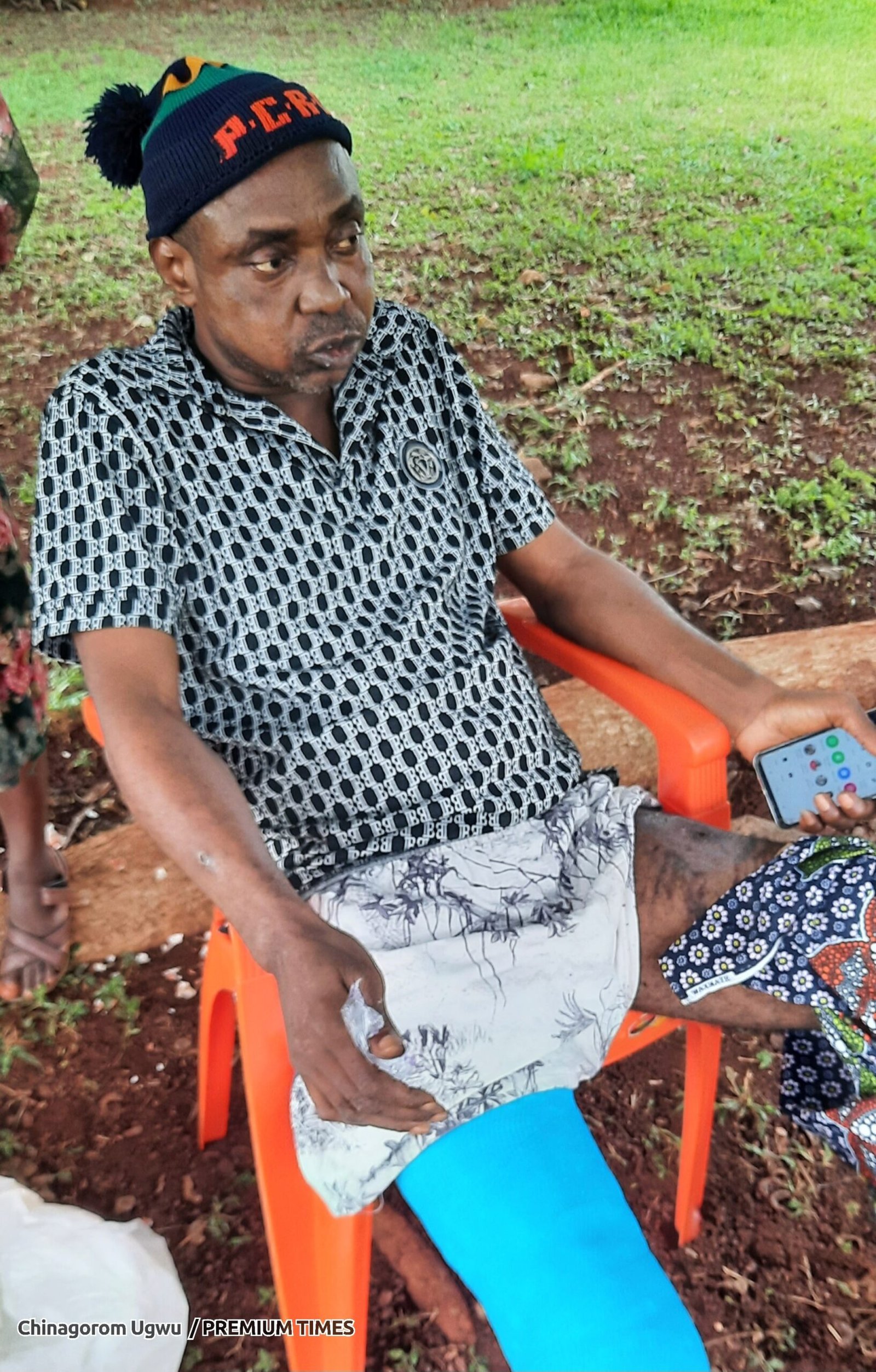 Patients at the National Orthopaedic Hospital, Enugu State