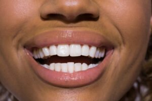 PT Health Watch: Why teeth whitening may harm your oral health