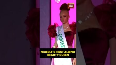 Nigeria’s Albinism Community Celebrates First Beauty Queen in Lagos