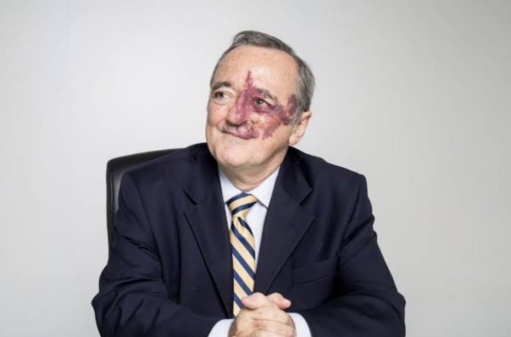 Spanish scientists eliminate pancreatic cancer in mice using triple-drug therapy