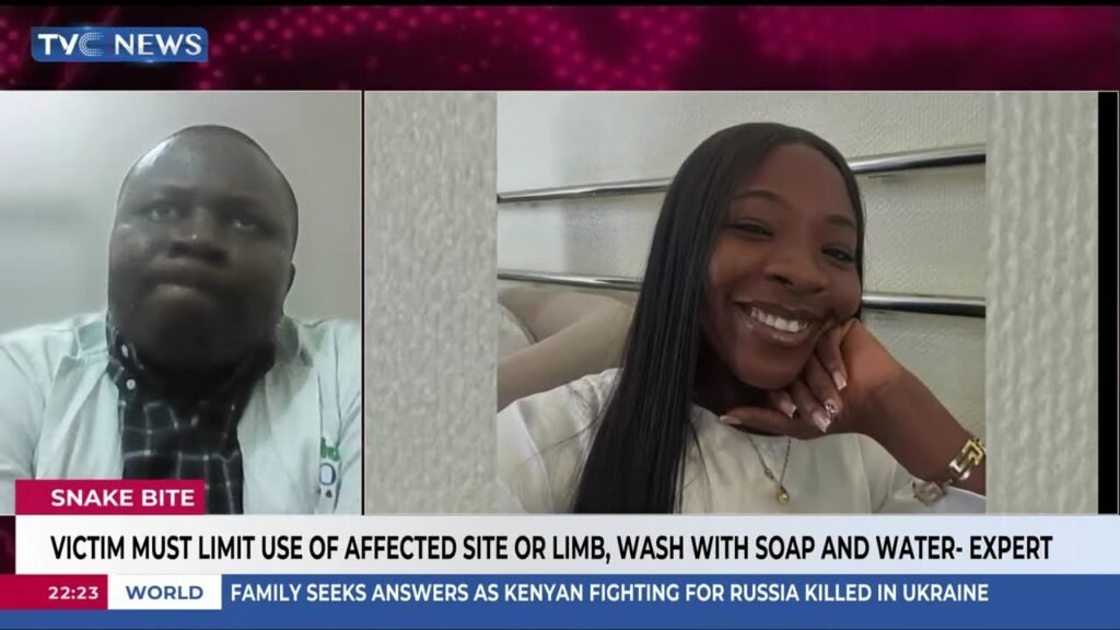 Ifunanya Nwangene’s Death: Expert Breaks Down What Makes a Snake Bite Deadly Ifunanya Nwangene’s Death: Expert Breaks Down What Makes a Snake Bite Deadly