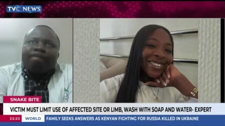 Ifunanya Nwangene’s Death: Expert Breaks Down What Makes a Snake Bite Deadly Ifunanya Nwangene’s Death: Expert Breaks Down What Makes a Snake Bite Deadly
