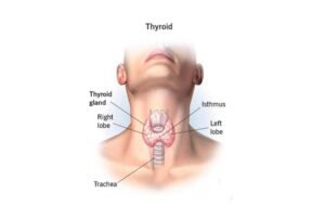 PT Health Watch: Persistent fatigue, weight changes may signal thyroid disorder – Expert PT Health Watch: Persistent fatigue, weight changes may signal thyroid disorder – Expert
