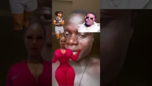 Every surgery get side effects #nigeria #hourglassbody #nigerianews #nigeriayoutube