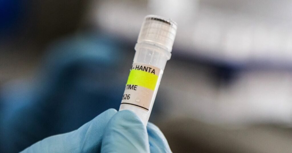 Hantavirus is much less contagious than COVID-19, expert say