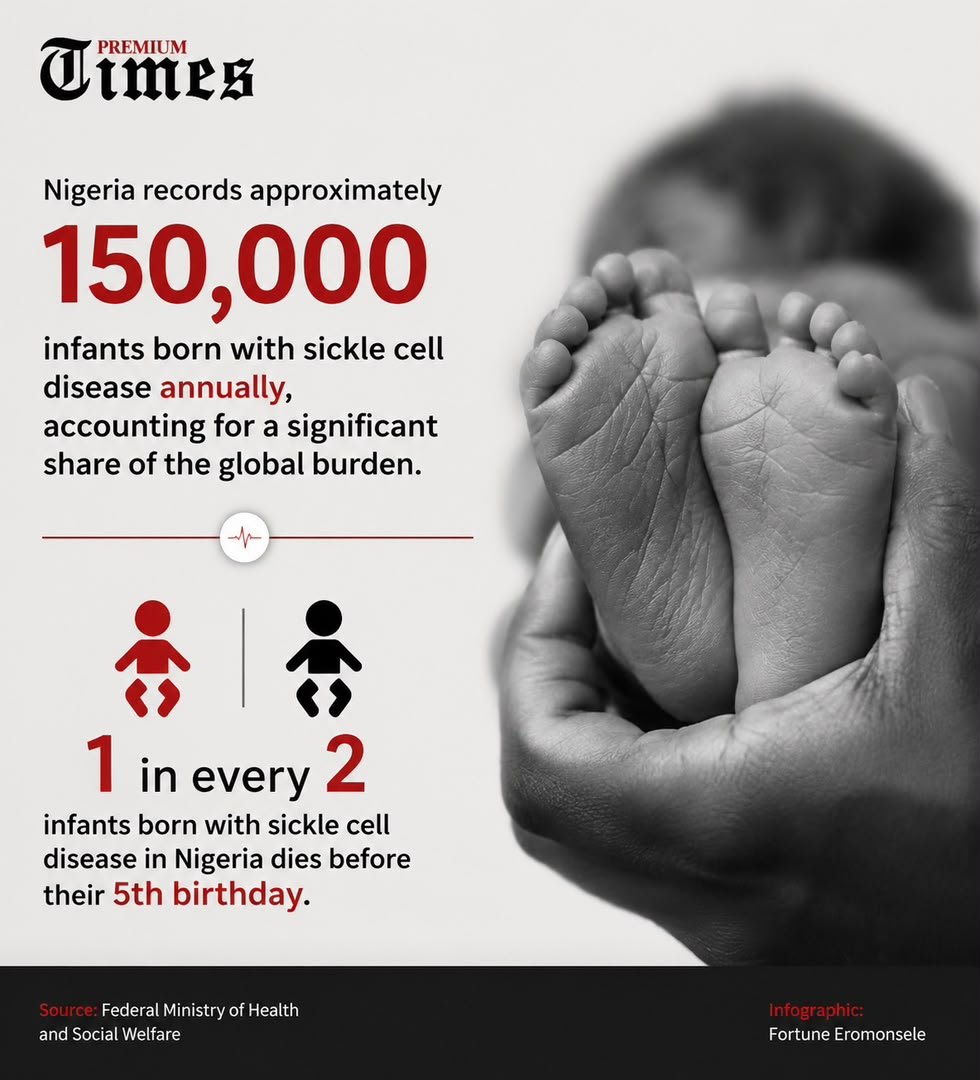 Rate of infants born with sickle cell disease annually.