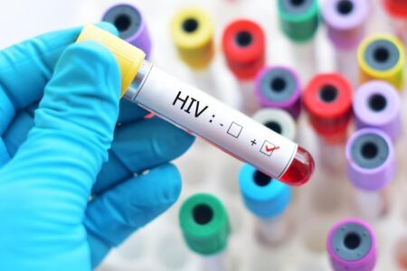 Interpretation of Lagos HIV data misleading, figures reflect routine testing- Official Interpretation of Lagos HIV data misleading, figures reflect routine testing- Official