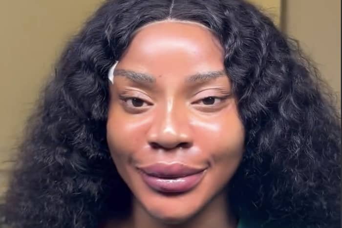 Uche Ogbodo after surgery (PHOTO CREDIT: Instagram @ucheogbodo)