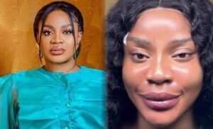 ‘I don’t like how I look’ – Uche Ogbodo after facial transformation ‘I don’t like how I look’ – Uche Ogbodo after facial transformation