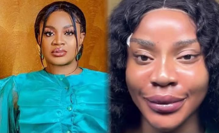 ‘I don’t like how I look’ – Uche Ogbodo after facial transformation ‘I don’t like how I look’ – Uche Ogbodo after facial transformation