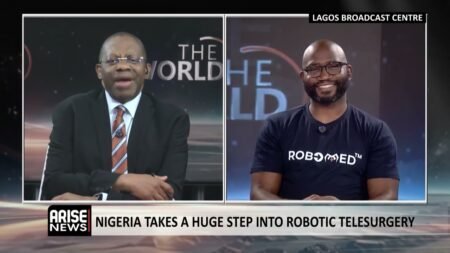 Nigeria Takes A Huge Step Into Robotic Telesurgery – Ekwenna Nigeria Takes A Huge Step Into Robotic Telesurgery – Ekwenna