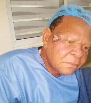 Baba Elesho undergoes surgery, dismisses cancer speculations Baba Elesho undergoes surgery, dismisses cancer speculations